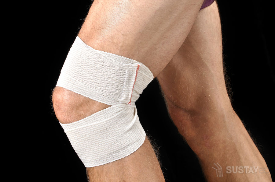 Остеопороз коленного сустава: симптомы и лечение 9-2