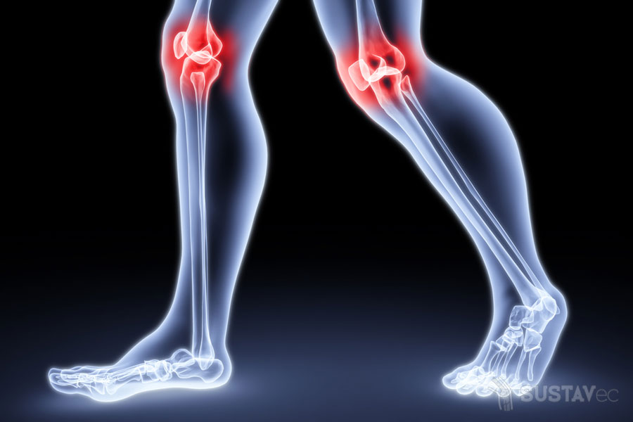 Лечение синовиальной жидкости в коленном суставе 1-4