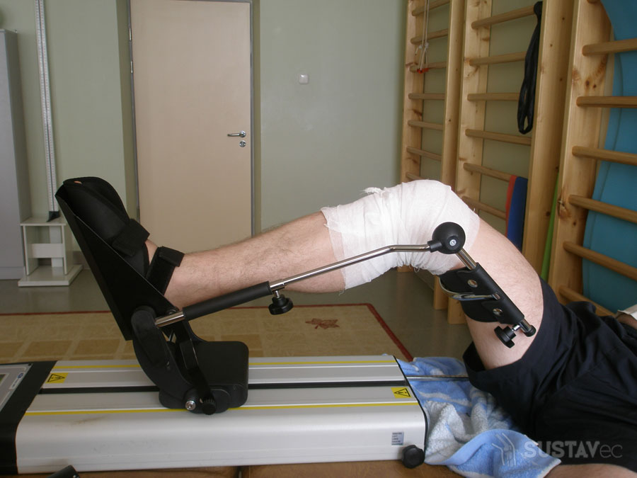 Реабилитация после операции эндопротезирования коленного сустава: периоды восстановления 15-3