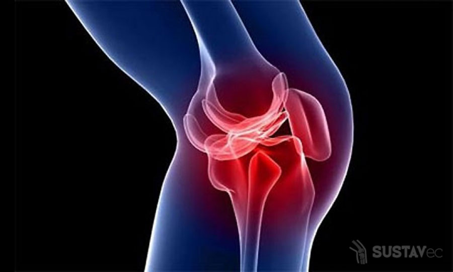 Симптомы и лечение супрапателлярного бурсита коленного сустава 18-2