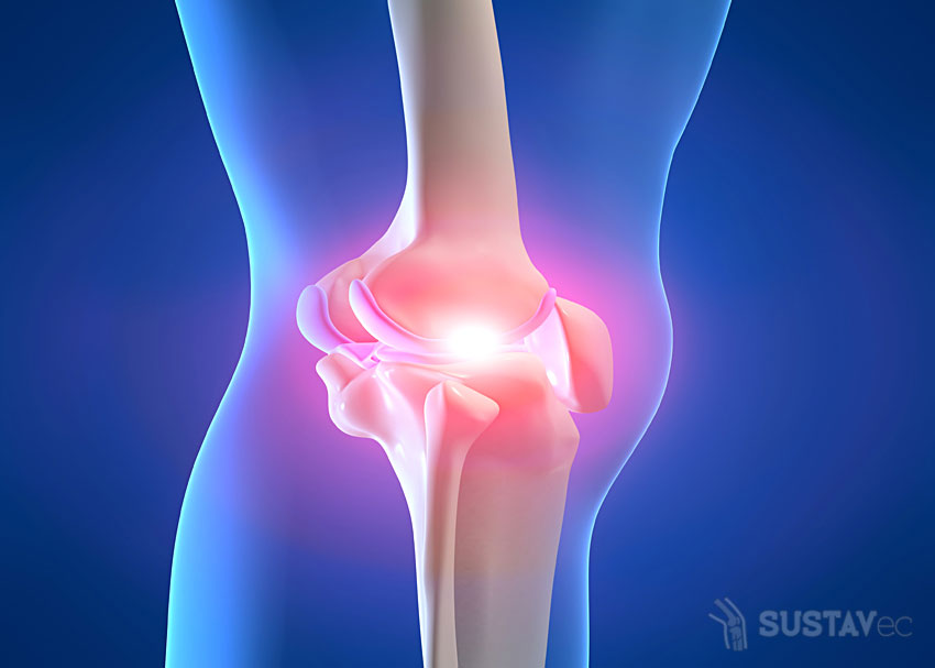 Симптомы и лечение воспаления коленного сустава: топ 6 методик 24-3