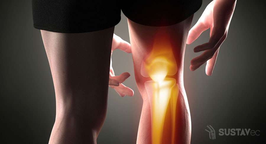 Симптомы и лечение периартрита коленного сустава 42-3