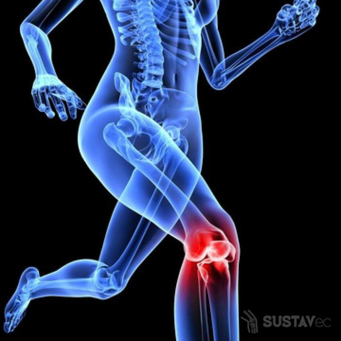 Лечение артроза коленного сустава 1 степени: 4 лучших методики 51-3