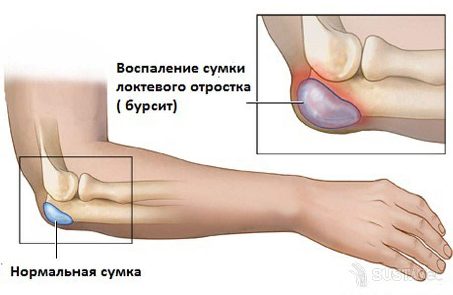 Анатомия локтевого сустава человека 12-6