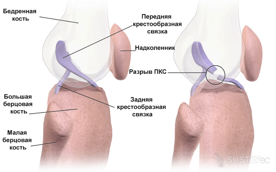 Симптомы и лечение растяжения связок локтевого сустава 59-1